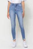 DISTRESSED ANKLE HIGH RISE SKINNY JEANS