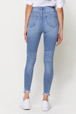 DISTRESSED ANKLE HIGH RISE SKINNY JEANS